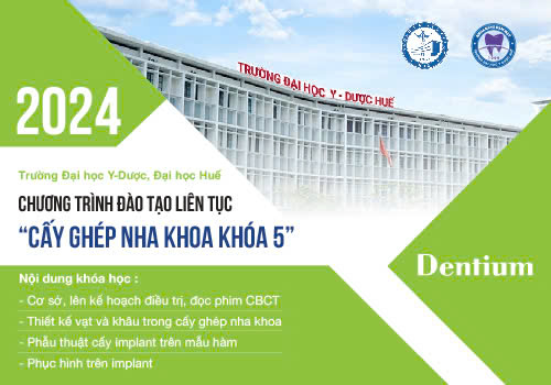  KHÓA HỌC ĐÀO TẠO LIÊN TỤC CẤY GHÉP NHA KHOA CƠ BẢN KHÓA 5 TẠI TRƯỜNG ĐẠI HỌC Y DƯỢC HUẾ